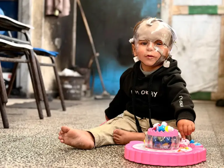 Two-year-old infant wears a facial pressure mask.
